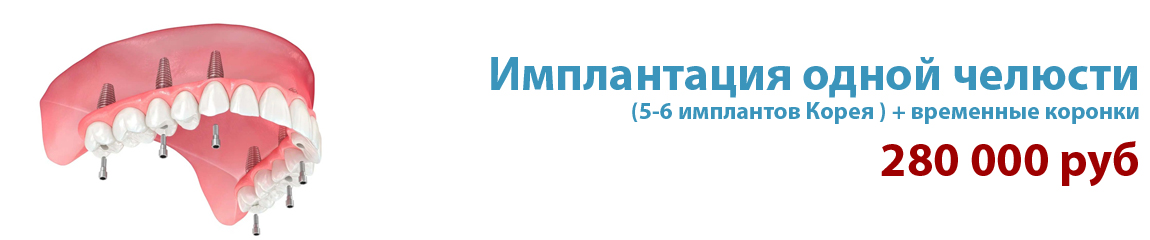 Slider Banner